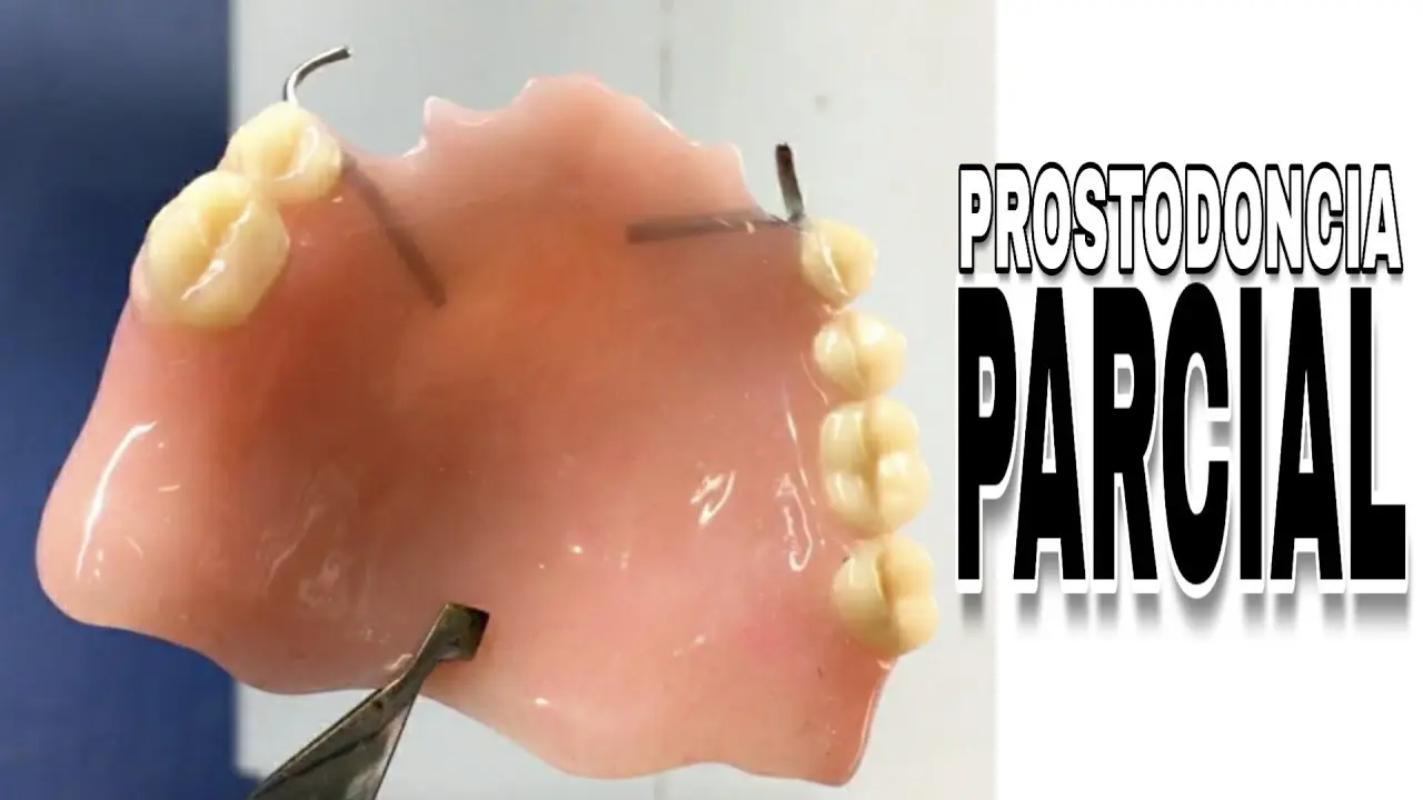 como ajustar doblar mi protesis de acrilico - Cómo domar una prótesis dental