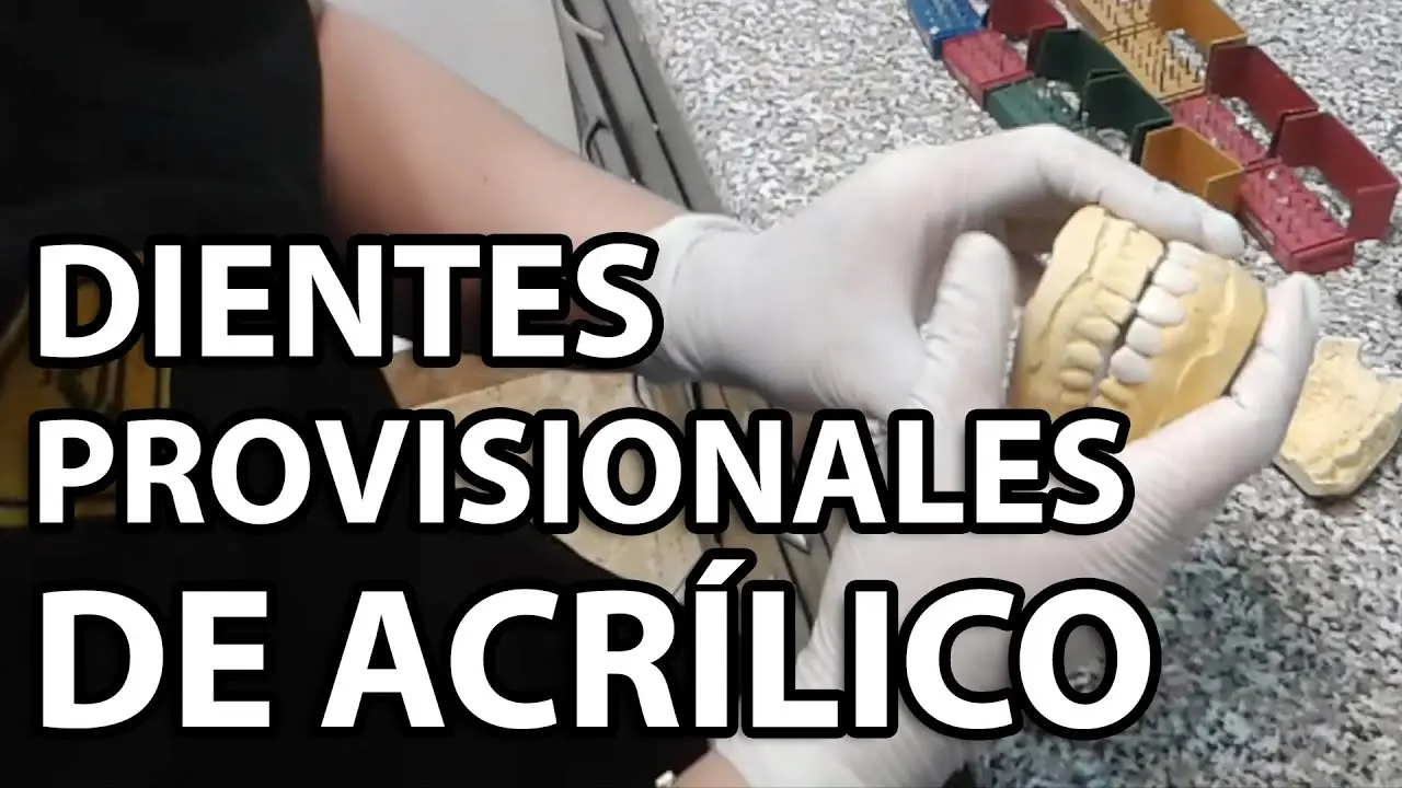 como agregar un diente a una protesis de acrilico - Cómo pegar un diente a una dentadura postiza