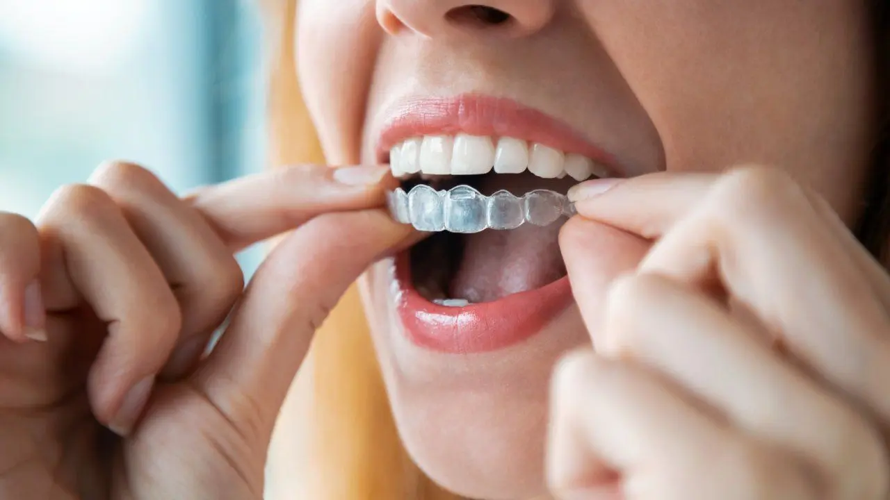¿Cómo sacar el mal olor del acrílico de los dientes? - Cómo quitar el mal olor en los dientes como sacar el mal olor del acrilico de los dientes - Cómo quitar el mal olor en los dientes