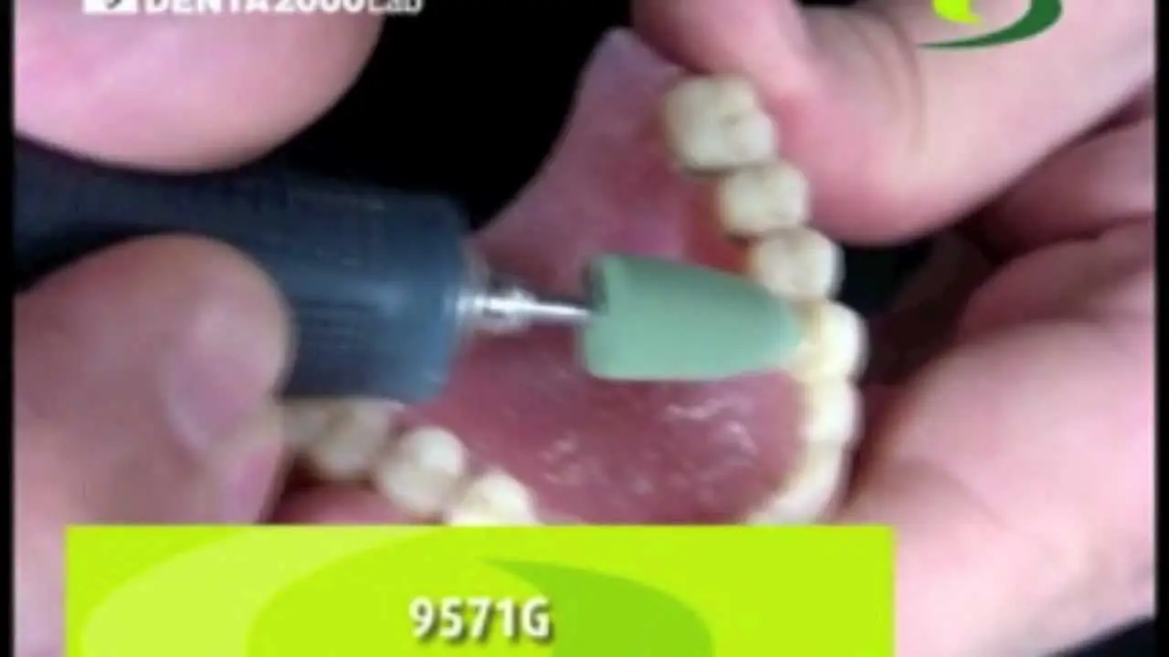 Cómo pulir provisionales de acrílico - Cómo saber si la prótesis dental está mal como pulir provisionales de acrilico - Cómo saber si la prótesis dental está mal