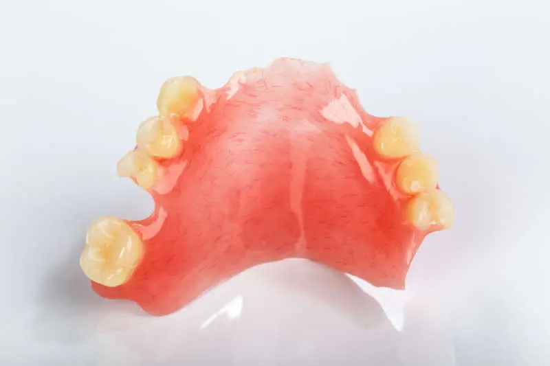 como enganchan una protesis de acrilico - Cómo se sostiene una prótesis dental