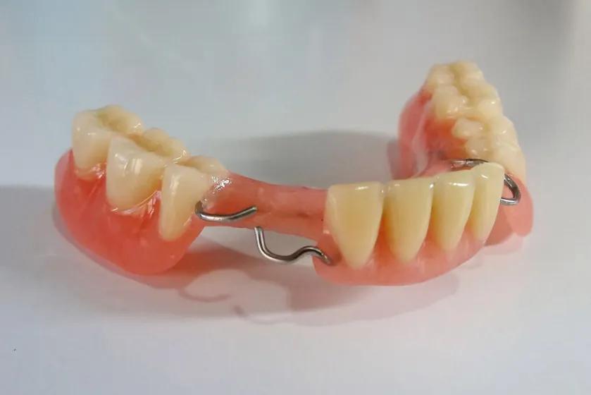 Diferencia entre cromo y acrílico en odontología - Qué es el cromo dental diferencia entre cromo y acrilico en odontologia - Qué es el cromo dental