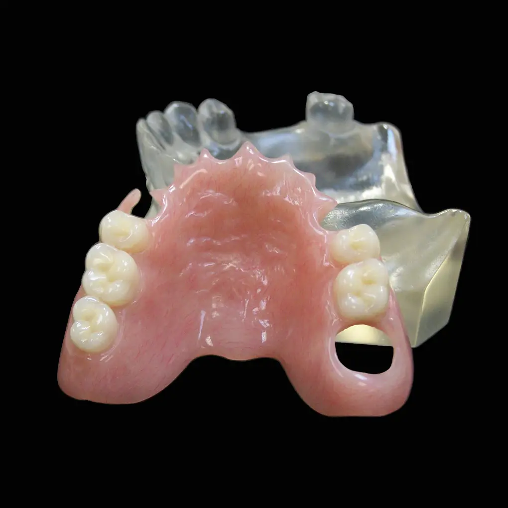 agregado de dientes y retenedores en protesis de acrilico - Qué son los retenedores en prótesis parcial removible
